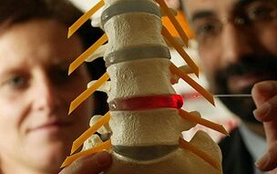 Krūtinės ląstos stuburo osteochondrozės simptomai ir gydymas