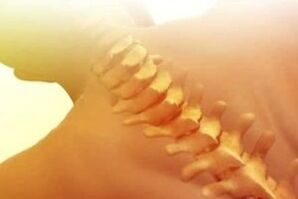 Kaip gydyti osteochondrozę